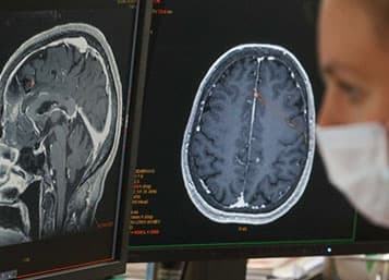 Brain scan images on monitors beside a masked clinician for the Nature COVID and the brain article