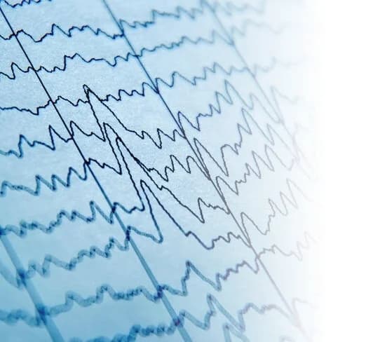A close view of recorded brainwave traces.